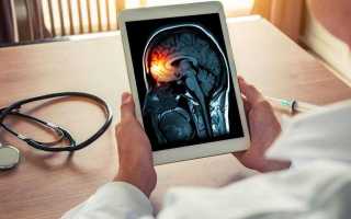 Голова болит местами мигрень