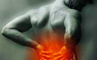 После резких движений болит спина