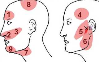 Весь день болит голова в области висков