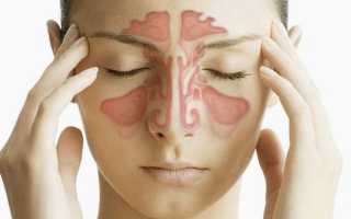 Каждый день заложен нос и болит голова