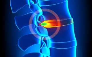 Болит спина в области левой лопатки и шея