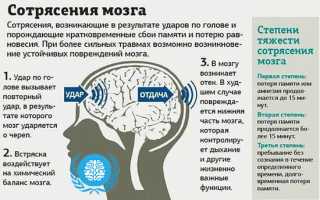 После сотрясения мозга болит голова что принимать