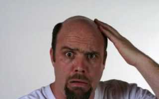 При выпадении волос болит кожа головы