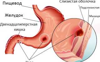 Может от того что болит спина болит голова и живот