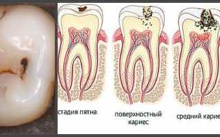 Болит зуб и вся эта сторона головы