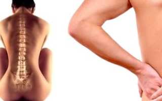 Болит спина в районе поясницы что это может быть