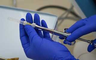 Если болит голова после вырывания зуба