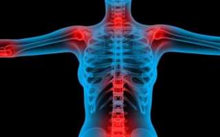 Болит спина между лопатками причины что