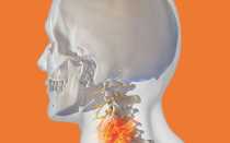 Что делать когда болит голова от шеи