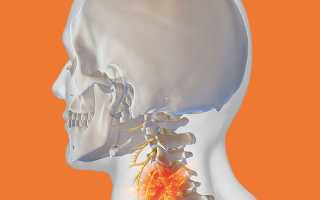 Что делать когда болит голова от шеи