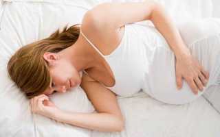 Беременность 39 недель весь день болит голова