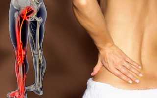 Что делать когда болит спина и все отдает в ноги и боля ноги