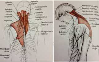 Какие упражнения нужно делать чтобы не болела голова