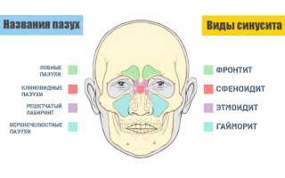 Болит нос и голова что это может быть