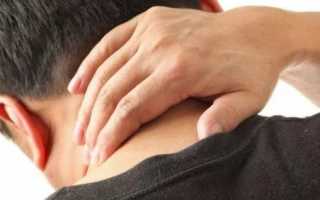 При наклоне головы болит голова в затылке