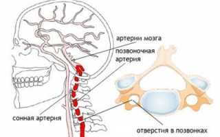 Боли в спине болит голова остеохондроз лечение