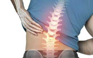 Если долго стоять на одном месте болит спина при