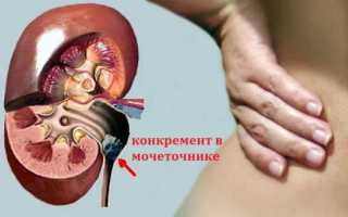 От чего может болеть левая половина спины