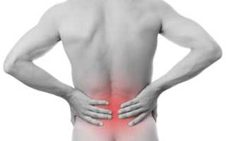 Болит спина у женщины отдает в ноги