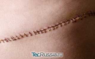 Болит шов на голове