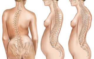 Болит спина в области лопаток врач