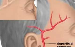 От чего может болеть правый весок головы