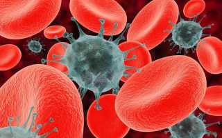 Как болит голова при раке крови