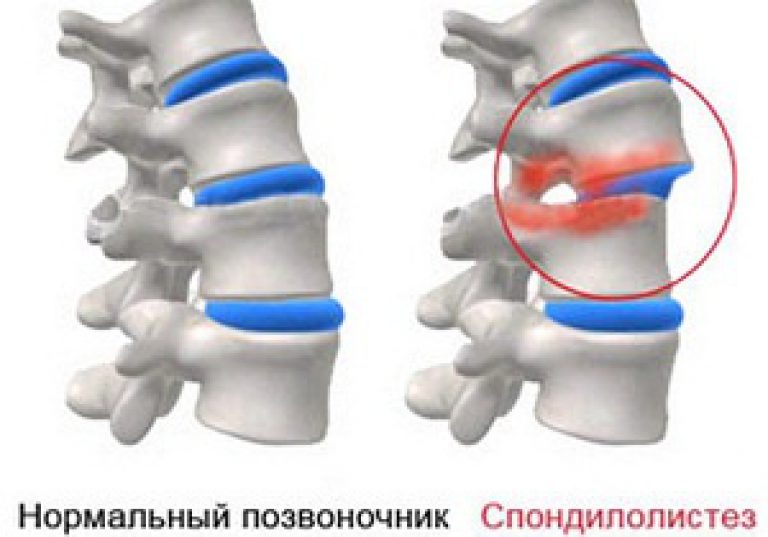 Болит спина и шея похрустывает
