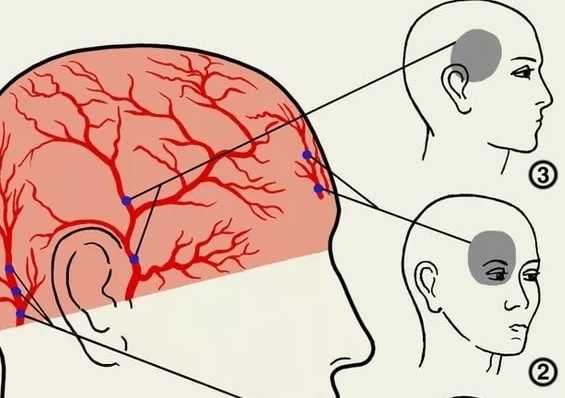 Напрягаю глаза болит голова