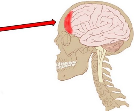 Болит лобовая часть головы что это