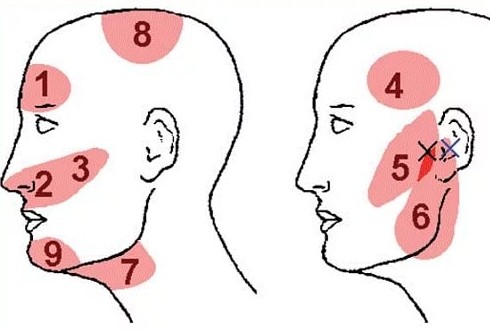 болит голова и виски что это за болезнь