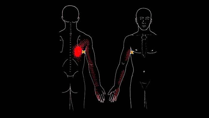 ÁÎËÈÒ ÑÏÈÍÀ Â ÎÁËÀÑÒÈ ËÎÏÀÒÊÈ: øèðî÷àéøàÿ ìûøöà ñïèíû Çäîðîâüå, Ìåäèöèíà, Àíàòîìèÿ, Ñïîðò, Ôèòíåñ, Âèäåî, Ãèôêà, Äëèííîïîñò