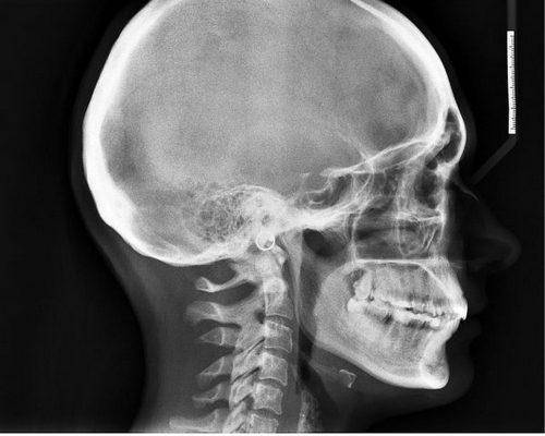 почему болит голова когда встаешь с пола