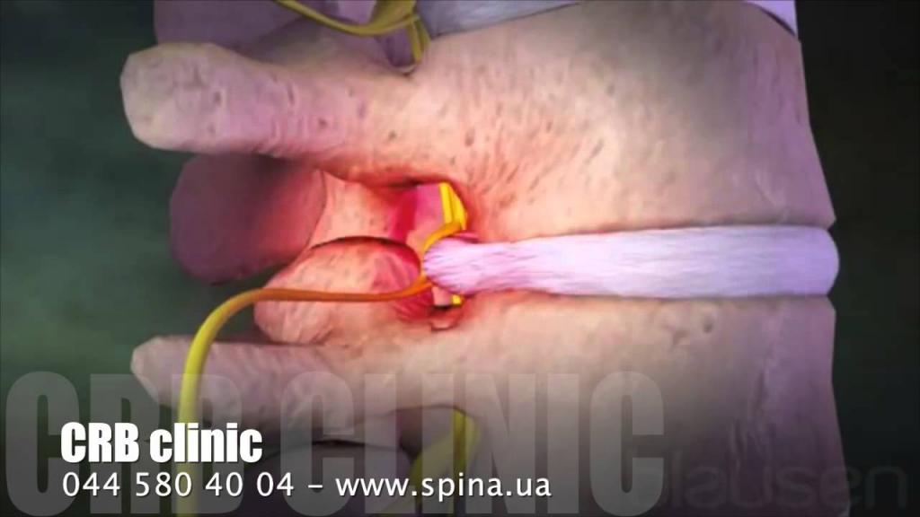 Постоянно болит и низ спина постоянно