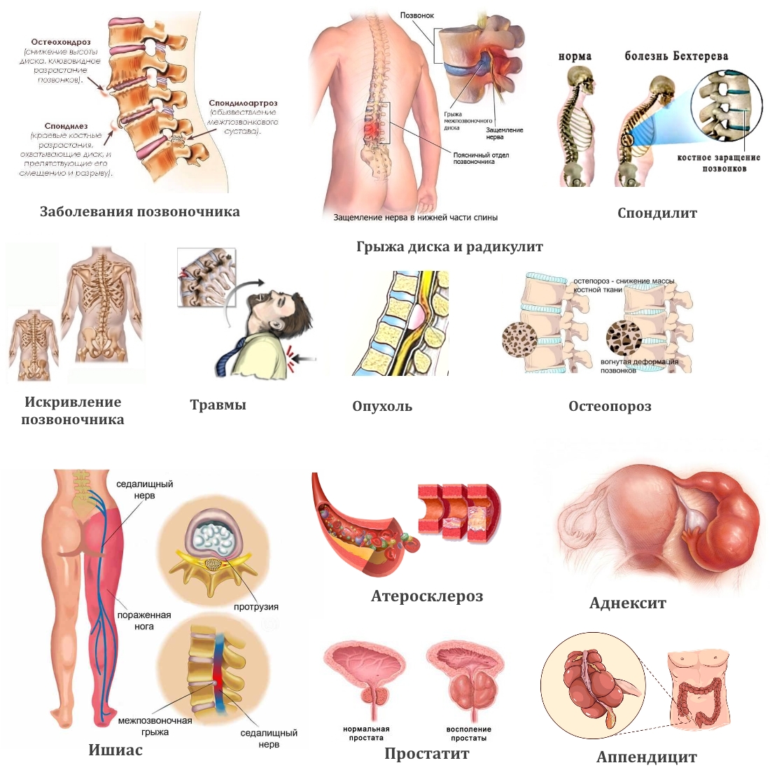 Частые причины боли в спине