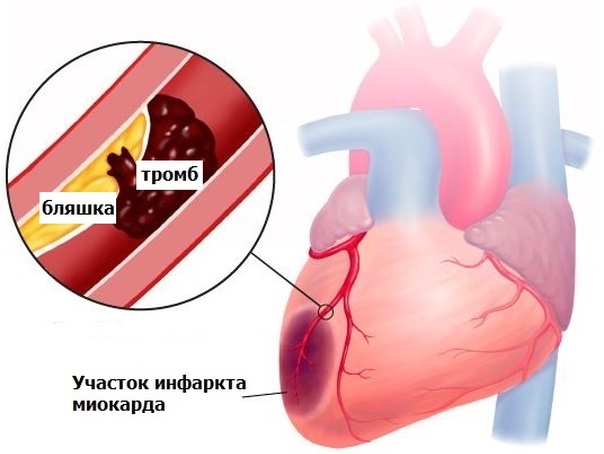 Болит спина в области лопаток врач