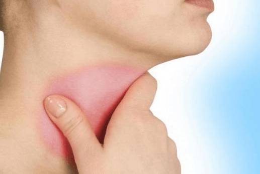 Болит горло и голова температуры нет что это может быть