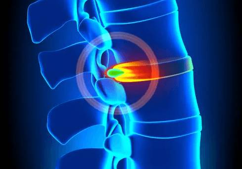 болит спина в области левой лопатки и шея