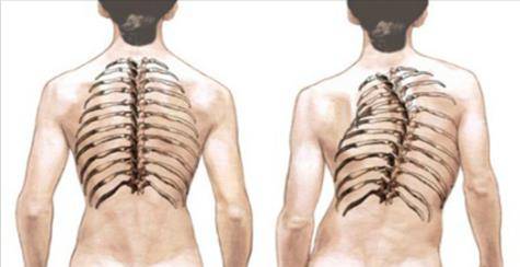 Болит спина если работать в наклоне