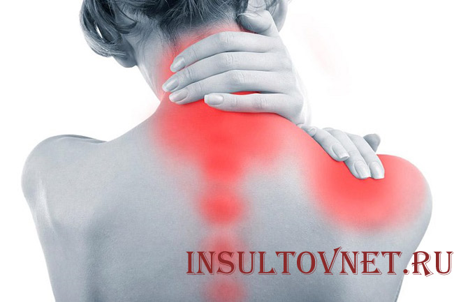 Симптомы шейного остеохондроза