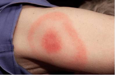 Слабость во всем теле и болит голова что может быть