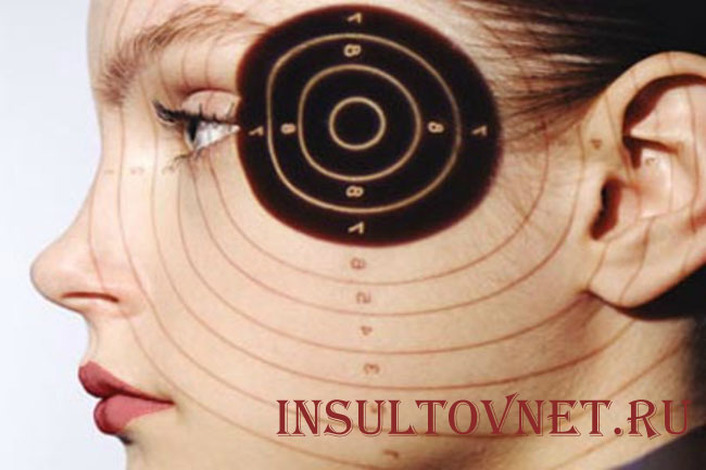 Височные боли при мигрени