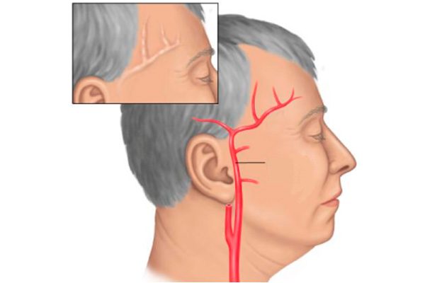 Что делать когда болит голова таблетки не помогают