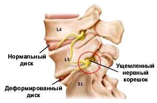 боль голова 3
