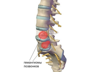 Если долго стоять на одном месте болит спина при
