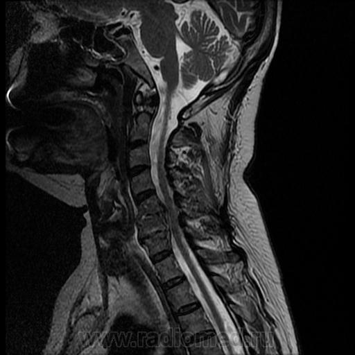 Болит спина и шея похрустывает