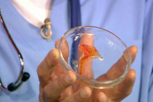 Мокрота с кровью