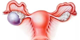 Болит спина справа отдает в пах и в ногу что это может быть