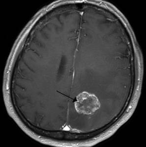 Слабость во всем теле и болит голова что может быть