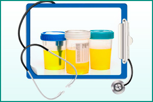 Анализ мочи